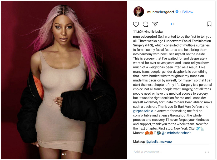 ffs surgery operatie Facial Feminization Surgery