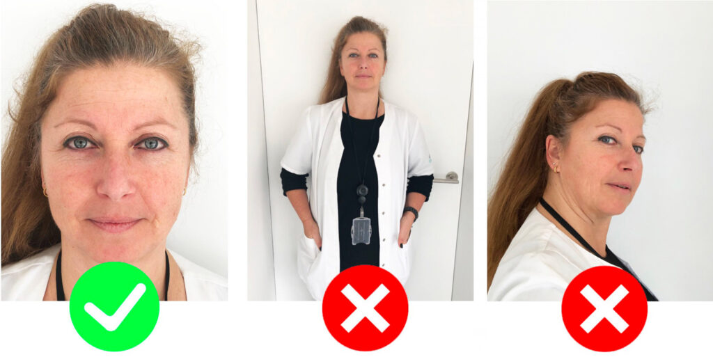 Facial Feminization Surgery