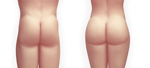 male vs female buttock
