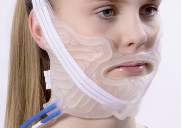 Permanente haarverwijdering