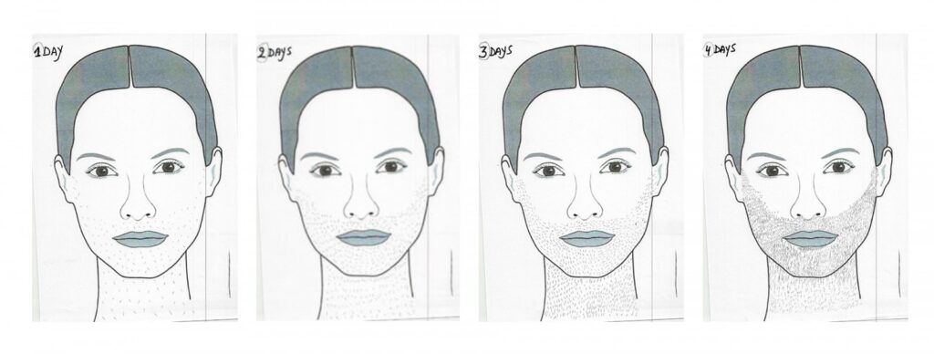 Intensieve verwijdering gezichtshaar