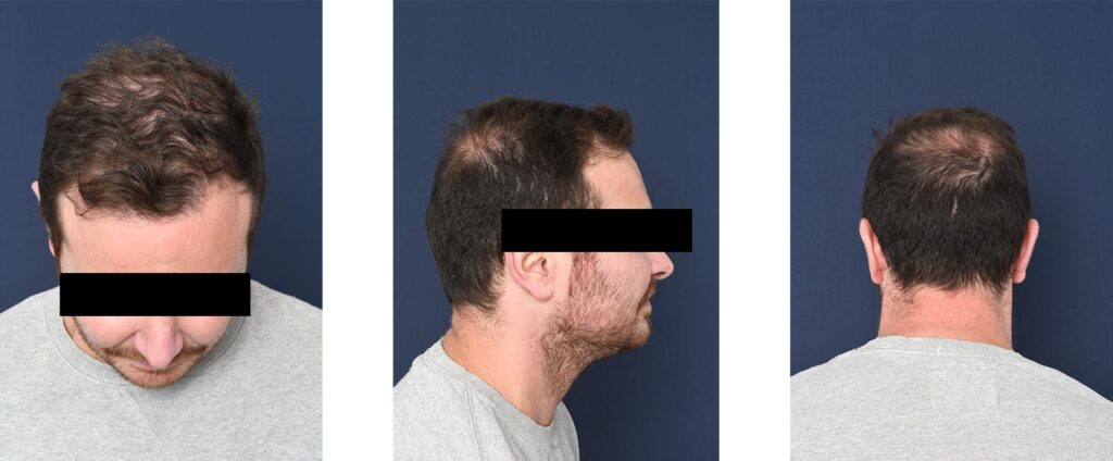 Vraag je offerte aan